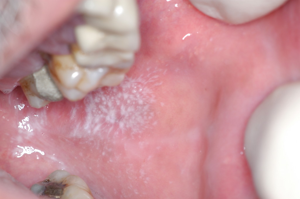 Medicina orale CSO Centro Specialistico Odontoiatrico